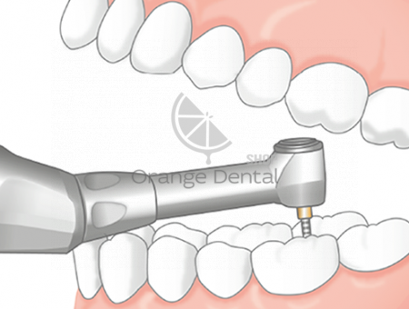 Эндомотор Endo-Mate TC2 - беспроводной  с миниатюрной головкой MP-F16R NSK | NSK Nakanishi (Япония)